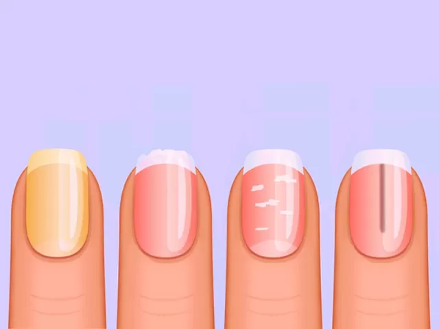 Nailed It: What Your Fingernails Say About Your Overall Health